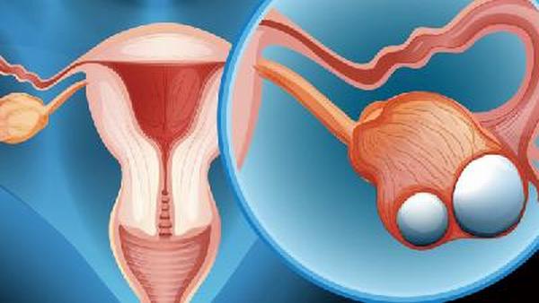 卵巢癌的4大食疗偏方