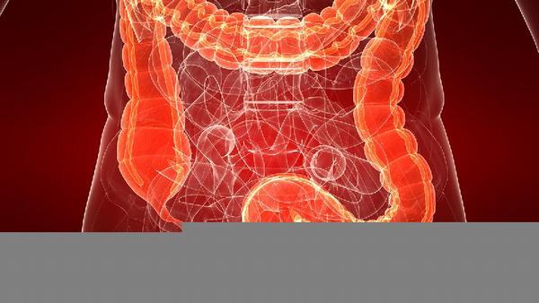 人们对肠癌的病因要有充分的了解