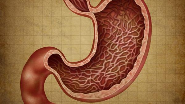 胃癌也有一定的遗传倾向