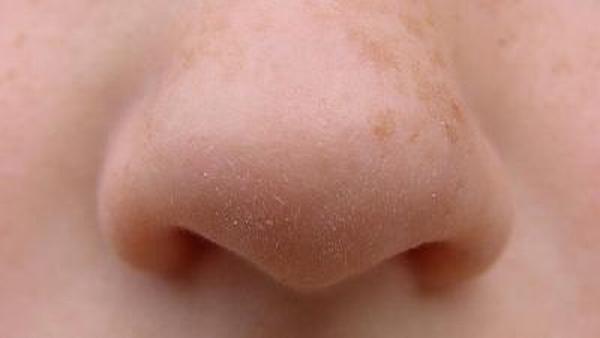 为何鼻咽癌发病率有增高之势