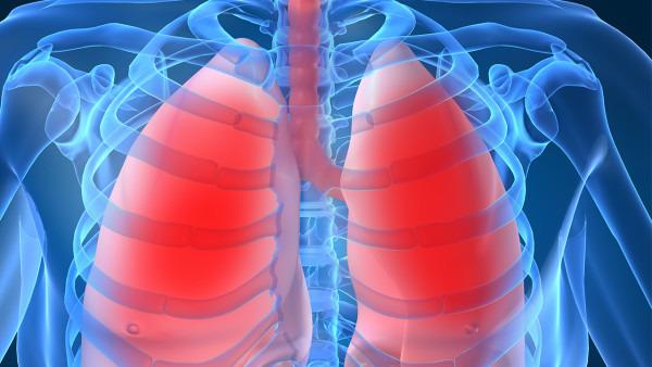 怎样去预防肺癌的发生