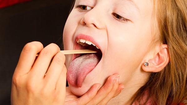 小孩子怎么会有舌癌呢