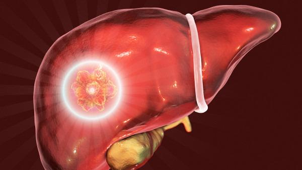 7个肝癌晚期饮食禁忌