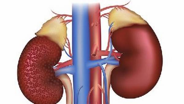 肾癌的8大原因是哪个部位