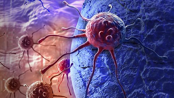 甲状腺癌的遗传变异是否会影响肿瘤的DNA修复机制和染色质稳定性