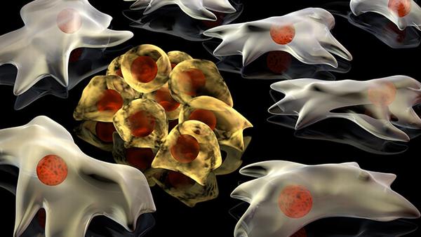 甲状腺癌的遗传变异是否会导致肿瘤的应激和抗氧化反应改变