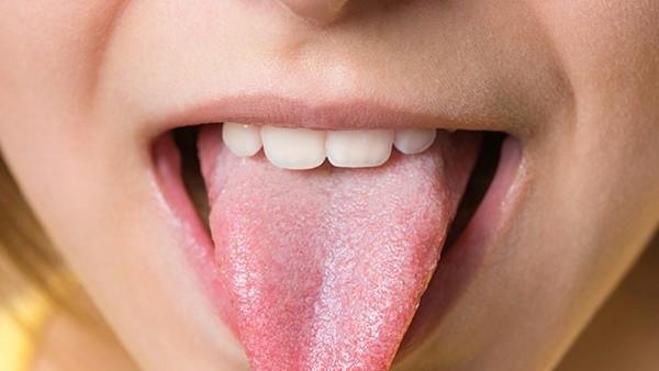 舌癌