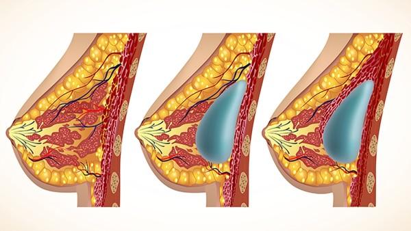 中药治疗胰腺癌有哪些方法