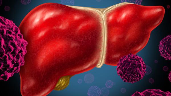 肝癌穿刺硬化多久可以治愈