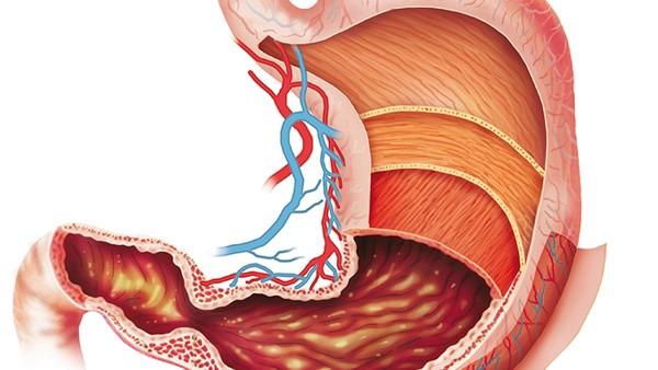胃癌为什么吃东西就会疼