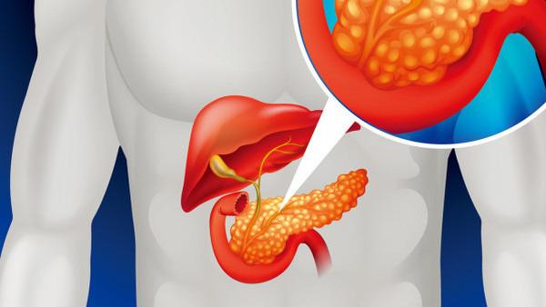 胆管癌建议腹腔镜吗多少钱