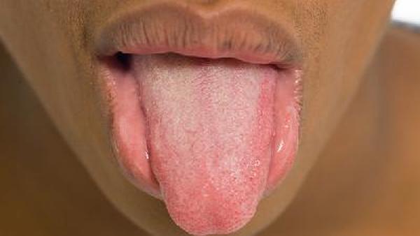 预防舌癌用什么牙膏好一点