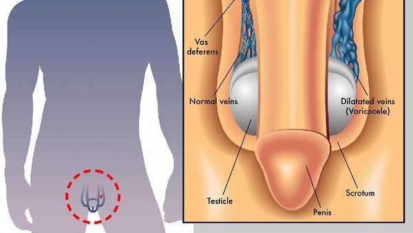 前列腺癌一般有什么危害
