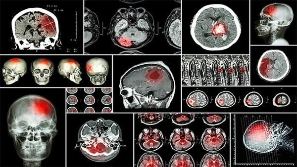 甲状腺结节叫什么癌症状