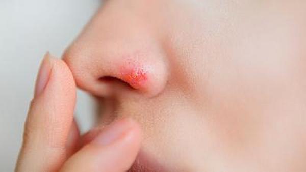 鼻咽癌背痛是什么原因