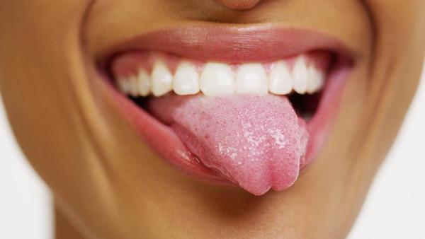 舌癌怎么分型判断轻重