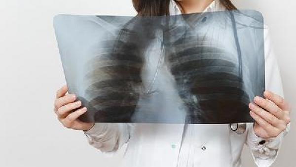 肺癌晚期咳血的危害有哪些