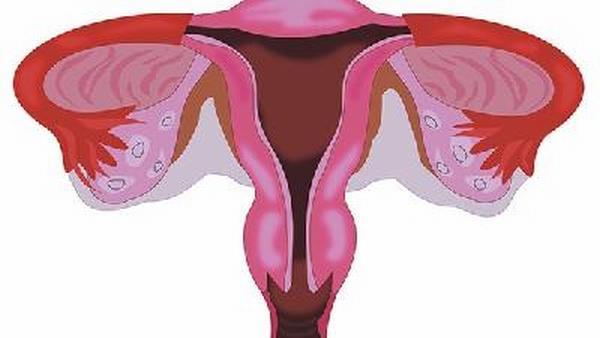 卵巢癌吃的什么靶向药
