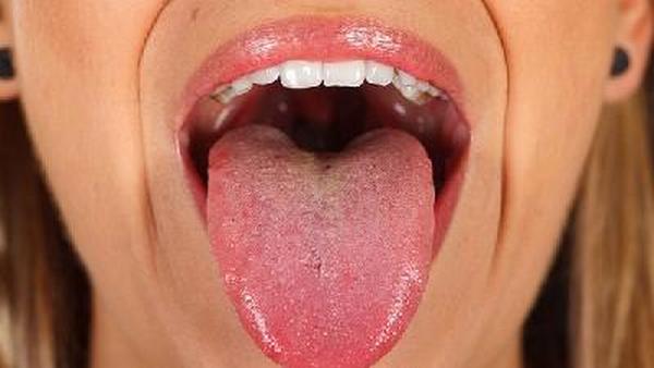 舌癌自己怎么检查