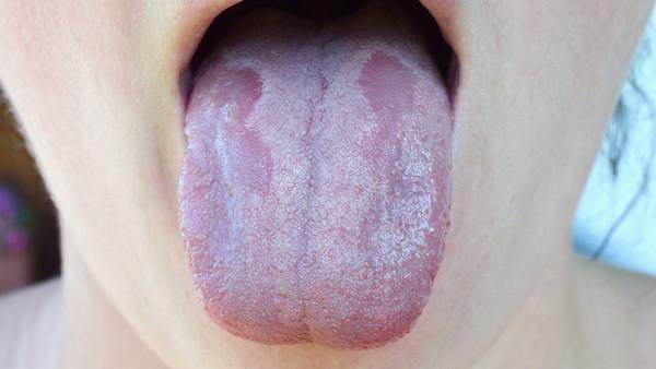 舌癌放疗七周多少钱