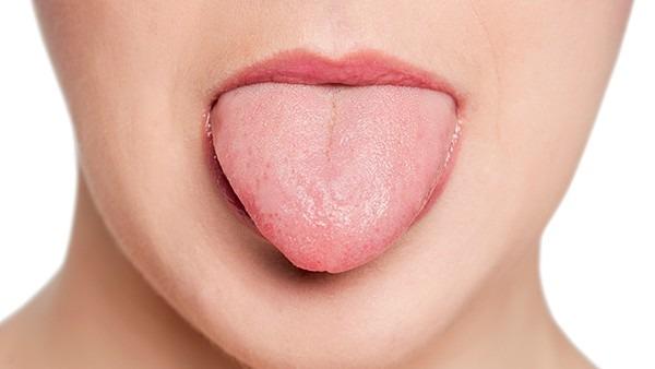 舌癌浸润是什么意思