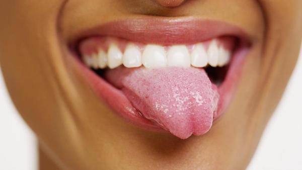 舌癌舌头上什么表现
