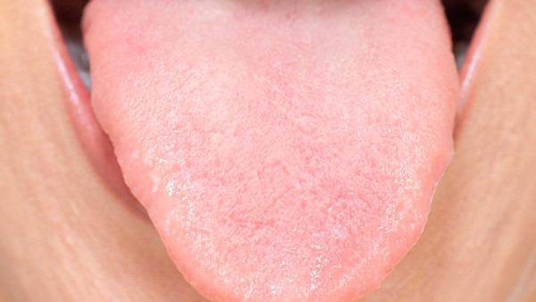 舌癌吃什么中成药