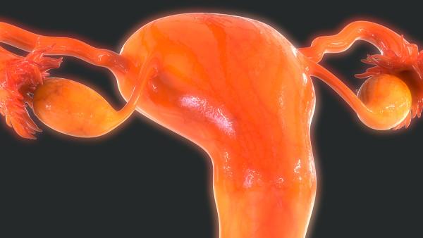 卵巢癌的早期信号吃什么