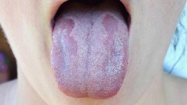 舌癌用什么中成药
