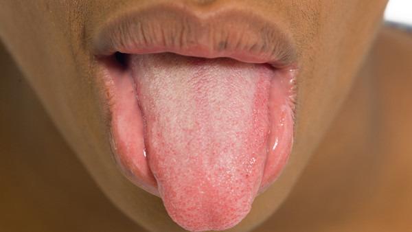 舌癌晚期反而不疼什么原因