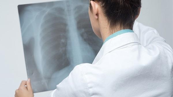放疗病人如何预防肺癌
