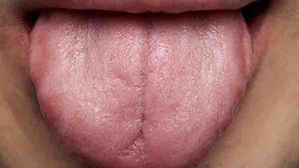 舌癌转移喉咙怎么办