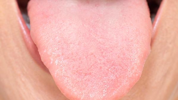 舌癌晚期用什么方法好