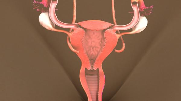 卵巢癌中医诊断是什么