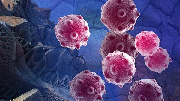 转移性卵巢癌晚期能活多久