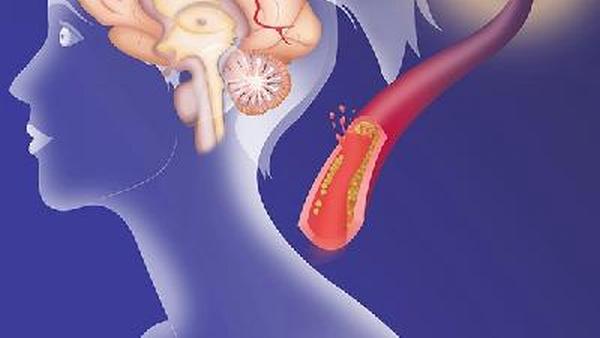 胃肠胶质瘤怎么能发现