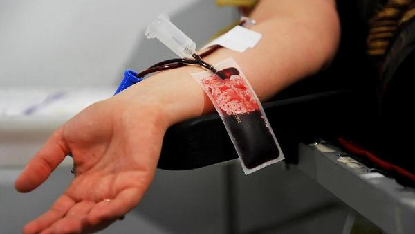 化验什么血项检查白血病