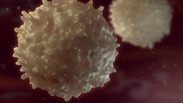 急性淋细胞白血病如何确诊