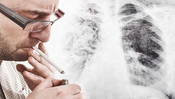 肺癌免费治疗怎么样
