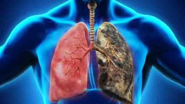 哪些肿瘤指标来确诊肺癌