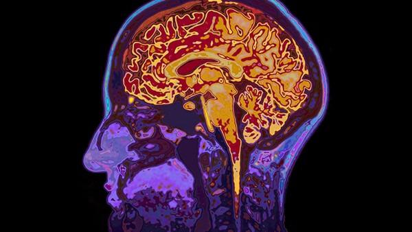 脑瘤怎么检查良性恶性
