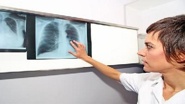 如何增强肺癌治疗的信心