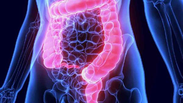 大肠癌有黑便的症状吗