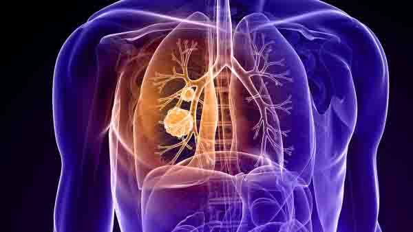 肺癌晚期吃靶向药可以活多久呀