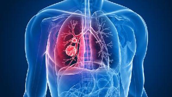 肺癌开始挂高蛋白还能活多久