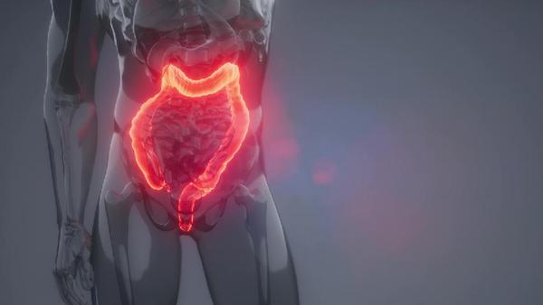 肠癌晚期的胃疼怎么办