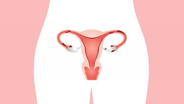 卵巢癌打什么针能治愈呢